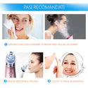 Aspirator Facial Vacuum pentru Curatare Puncte Negre, Acnee si Pori Trendysale.ro