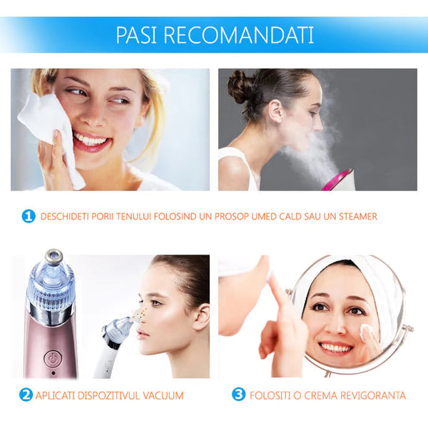 Aspirator Facial Vacuum pentru Curatare Puncte Negre, Acnee si Pori Trendysale.ro